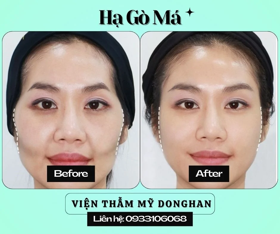 Phòng Khám Thẩm Mỹ DongHan
